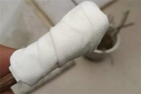 枝条上裹个卫生纸 枝条上裹个卫生纸